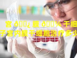 宫 🌿 膜 🐼 干细胞100问（子宫内膜干细胞治疗多少钱）